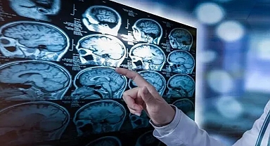 Hafızamız sabit değilmiş: Beyin, aynı anıyı her seferinde farklı kaydediyor