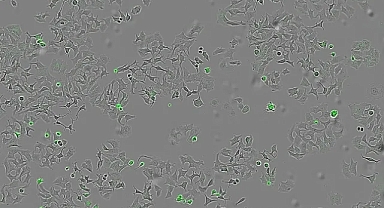 Umut verici çalışma: Bir bakteri türünün salgıladığı proteinle kanser hücreleri yok edildi