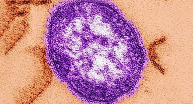 ABD'de yüzlerce kişi kızamık salgınında karantinaya alındı