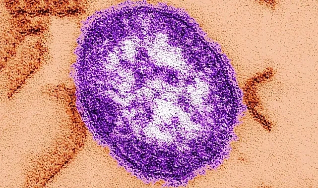 ABD'de yüzlerce kişi kızamık salgınında karantinaya alındı